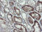 C-Type Lectin Domain Family 4 Member E antibody, M06084-1, Boster Biological Technology, Immunohistochemistry paraffin image 