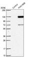 Family With Sequence Similarity 186 Member B antibody, NBP1-88389, Novus Biologicals, Western Blot image 