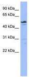 Zinc Finger Protein 419 antibody, TA341395, Origene, Western Blot image 