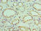 NADH:Ubiquinone Oxidoreductase Subunit B7 antibody, A52022-100, Epigentek, Immunohistochemistry paraffin image 
