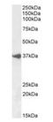 Basic Helix-Loop-Helix Family Member E22 antibody, orb389357, Biorbyt, Western Blot image 