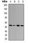 Ubiquilin 4 antibody, orb319049, Biorbyt, Western Blot image 