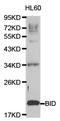 BH3 Interacting Domain Death Agonist antibody, TA326772, Origene, Western Blot image 