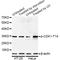 Cyclin Dependent Kinase 1 antibody, STJ22058, St John