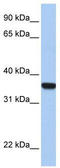 Homeobox D1 antibody, TA330643, Origene, Western Blot image 