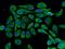 PPFIA Binding Protein 2 antibody, 13953-1-AP, Proteintech Group, Immunofluorescence image 
