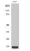 Cyclin Dependent Kinase Inhibitor 2C antibody, STJ94860, St John