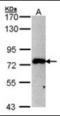 Membrane Palmitoylated Protein 5 antibody, orb89976, Biorbyt, Western Blot image 
