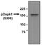 Death Associated Protein Kinase 1 antibody, MA1-24738, Invitrogen Antibodies, Western Blot image 