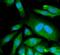 Cyclin Dependent Kinase 6 antibody, FNab01561, FineTest, Immunofluorescence image 