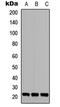 TGFB Induced Factor Homeobox 2 Like Y-Linked antibody, LS-C354487, Lifespan Biosciences, Western Blot image 