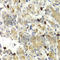 Matrix Metallopeptidase 9 antibody, A2095, ABclonal Technology, Immunohistochemistry paraffin image 