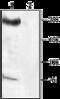 Sodium Voltage-Gated Channel Alpha Subunit 8 antibody, GTX54842, GeneTex, Western Blot image 