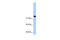 Structural Maintenance Of Chromosomes 3 antibody, 30-301, ProSci, Enzyme Linked Immunosorbent Assay image 