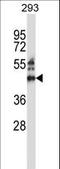 Zinc Finger Protein 660 antibody, LS-C160928, Lifespan Biosciences, Western Blot image 