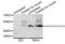 Glycogen Synthase Kinase 3 Alpha antibody, AHP2625, Bio-Rad (formerly AbD Serotec) , Western Blot image 