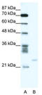 A1 antibody, TA330408, Origene, Western Blot image 