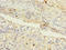 Melanoma-associated antigen 9 antibody, A59730-100, Epigentek, Immunohistochemistry paraffin image 