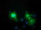 V-Set And Immunoglobulin Domain Containing 2 antibody, LS-C172366, Lifespan Biosciences, Immunofluorescence image 