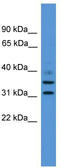 GTPase, IMAP Family Member 6 antibody, TA335463, Origene, Western Blot image 