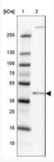 Chromosome 4 Open Reading Frame 17 antibody, NBP2-31831, Novus Biologicals, Western Blot image 