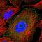 Fermitin Family Member 2 antibody, PA5-59200, Invitrogen Antibodies, Immunofluorescence image 