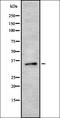 P2Y Receptor Family Member 10 antibody, orb336447, Biorbyt, Western Blot image 