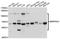Plasma protease C1 inhibitor antibody, A1717, ABclonal Technology, Western Blot image 