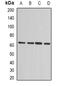Microseminoprotein Beta antibody, abx225295, Abbexa, Western Blot image 