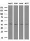 STN1 Subunit Of CST Complex antibody, MA5-25628, Invitrogen Antibodies, Western Blot image 