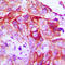 Ret Proto-Oncogene antibody, GTX54984, GeneTex, Immunohistochemistry paraffin image 