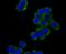 Protein diaphanous homolog 1 antibody, NBP2-75470, Novus Biologicals, Immunocytochemistry image 