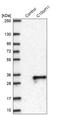 Leucine Rich Melanocyte Differentiation Associated antibody, NBP2-14370, Novus Biologicals, Western Blot image 