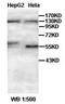 Serine/threonine-protein kinase TAO3 antibody, orb77145, Biorbyt, Western Blot image 