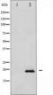 OP18 antibody, TA325914, Origene, Western Blot image 