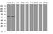 ACD antibody, NBP2-45475, Novus Biologicals, Western Blot image 