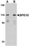Zinc Finger FYVE-Type Containing 26 antibody, orb89231, Biorbyt, Western Blot image 