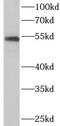 Cytochrome P450 Family 19 Subfamily A Member 1 antibody, FNab02146, FineTest, Western Blot image 