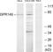 G Protein-Coupled Receptor 149 antibody, TA316375, Origene, Western Blot image 
