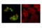 TBR2 antibody, 81493S, Cell Signaling Technology, Immunofluorescence image 