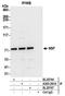N-Ethylmaleimide Sensitive Factor, Vesicle Fusing ATPase antibody, A305-261A, Bethyl Labs, Immunoprecipitation image 