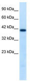 Hnf-1b antibody, TA330247, Origene, Western Blot image 
