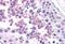 Cathelicidin Antimicrobial Peptide antibody, MBS242692, MyBioSource, Immunohistochemistry paraffin image 