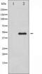 ADRB2 antibody, TA325209, Origene, Western Blot image 