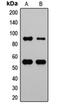 MDM2 Proto-Oncogene antibody, orb216152, Biorbyt, Western Blot image 