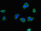 Phenylalanine Hydroxylase antibody, A63090-100, Epigentek, Immunofluorescence image 