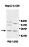 Josephin Domain Containing 1 antibody, orb78078, Biorbyt, Western Blot image 