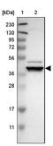 DnaJ Heat Shock Protein Family (Hsp40) Member C28 antibody, NBP1-88273, Novus Biologicals, Western Blot image 