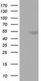 CD5 Molecule antibody, LS-C797971, Lifespan Biosciences, Western Blot image 