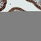 Nicotinate Phosphoribosyltransferase antibody, AMAb90725, Atlas Antibodies, Immunohistochemistry paraffin image 